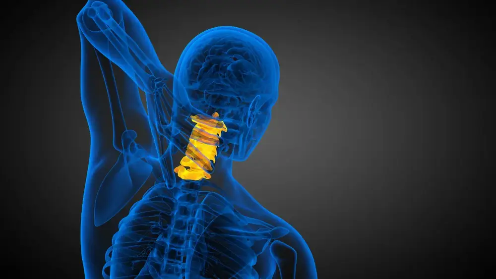 Esclerose Múltipla Coluna Cervical